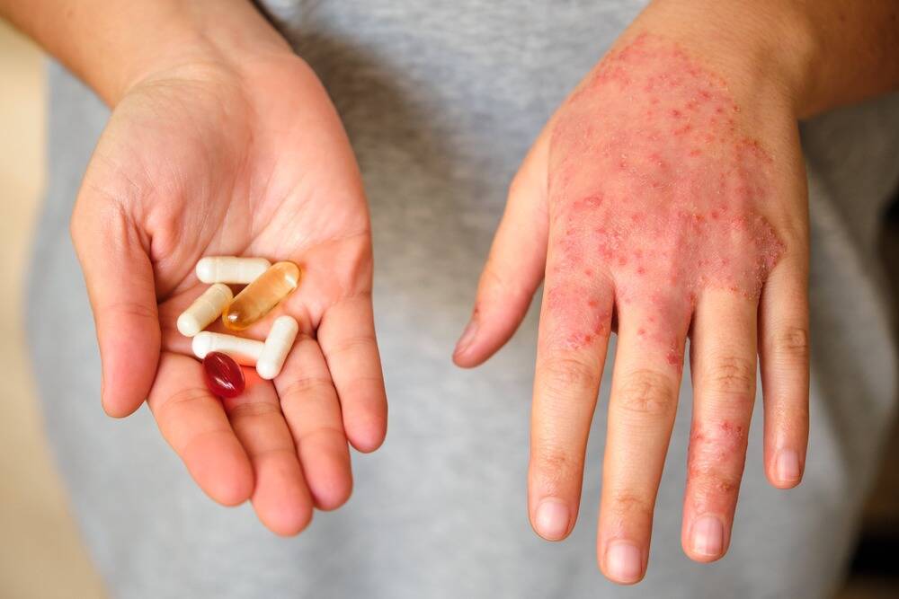 Why Drug Abuse is Not Just Harming Your Body, but Your Skin Too